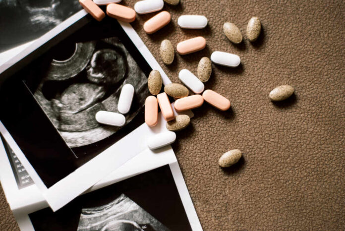 Photo,Of,The,Fetus,On,An,Ultrasound,Scan,And,Few