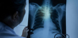 Doctor examining a chest X-ray with a stethoscope in hand