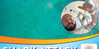 Florida Man Survives Brutal Shark Attack Florida Man Recalls Terrifying 7-Foot Nurse Shark Bite Near Key West