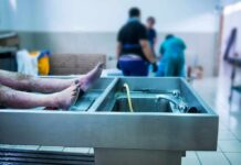 Anonymous Donor Ends Crucial Evidence? cadaver on stainless autopsy table in clinical room