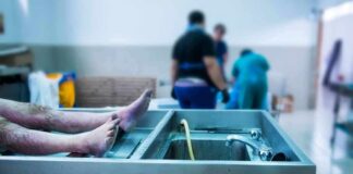 Anonymous Donor Ends Crucial Evidence? cadaver on stainless autopsy table in clinical room