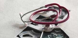 Legal Void Ends – But With Strings Stethoscope on ultrasound photos